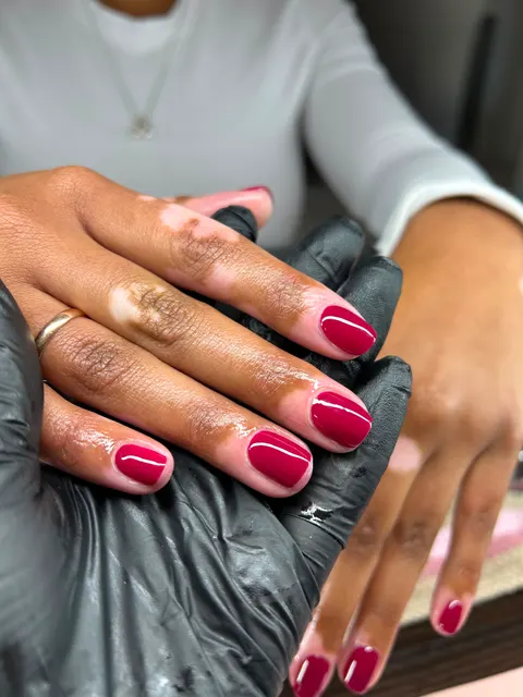 Berry Overlay